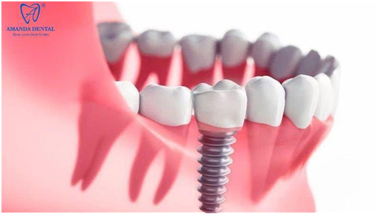 Bệnh viện CATP thông tin kiến thức RHM